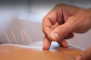 Acupuncture Phnom Penh