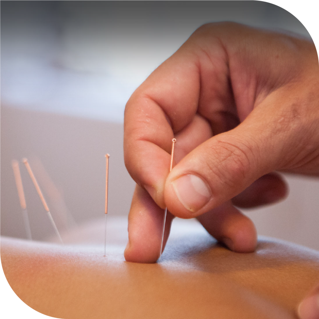 Acupunture at Sâmata, Medical and Wellness
