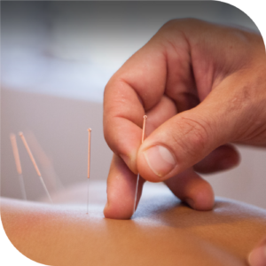 Acupunture at Sâmata, Medical and Wellness